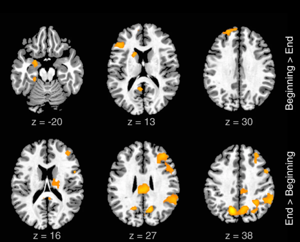 Brain scans showing how improvisation-related activity shifts from the beginning to the end of each 8-bar segment