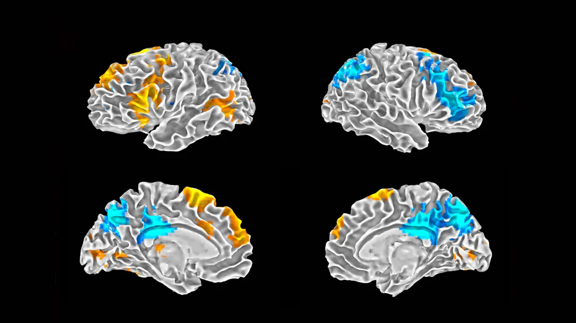 Brain scans contrasting activity during improvised rap versus a rehearsed, memorized verse